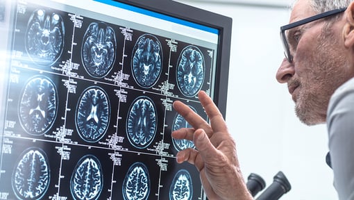 Person viewing multiple brain scan images displayed on a computer monitor, with a hand gesturing toward the screen.